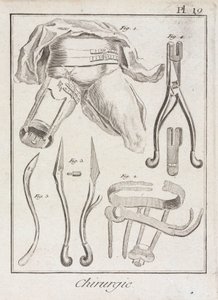 Frühneuzeitliche orthopädische Chirurgie