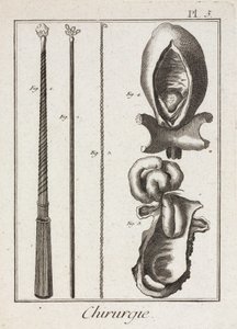 Ausrüstung, frühmoderne chirurgische Instrumente und Diagramme von Körperteilen