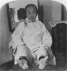 Die zarten Lilienfüße einer hochkastigen Dame, Methode der Deformierung, China, 1900