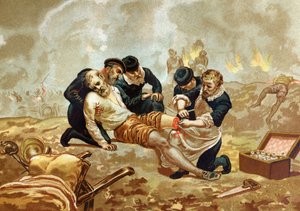 Ambroise Pare Arzt und französischer Chirurg (ca. 1509-1590) praktiziert die Ligatur von Arterien nach der Amputation. aus „Hombres y Mujeres celebres“. Barcelona 1877. von Unknown artist