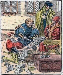 Beinamputation im 16. Jahrhundert von Unknown artist