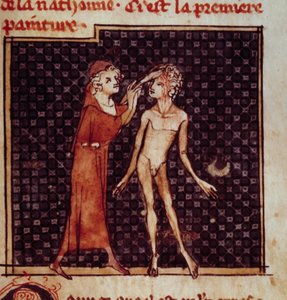 Anatomische Figur: Der Chirurg schneidet die Stirn eines Patienten auf. Miniatur aus dem Manuskript „Chirurgie“ von Henri de Mondeville von Unknown artist