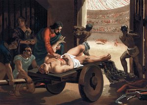 Claude Galien (Klaudios Galenos oder Claudio Galeno oder Claudius Galenus oder Galen, ca. 131 - ca. 201), griechischer Arzt behandelt einen Gladiator. Barcelona 1881 von Unknown artist