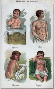 Kinderkrankheiten: Nesselsucht, Masern, Krätze, Scharlach. In „Die neue natürliche Heilung“ von F.E. Bilz. von Unknown artist