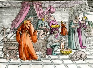 Arzt: „Eine Trepanation“. Ein Chirurg operiert den Schädel seines Patienten. Gravur aus dem 16. Jahrhundert Private Sammlung von Unknown artist