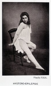 Hystero Epilepsie - Kontraktur in „Photographische Ikonographie der Salpêtrière: Dienst von Herrn Charcot“ von Paul Regnard und Bourneville von Unknown artist