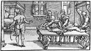 Reduktion einer Luxation, in „Traitè Médical“ von Ambroise Paré, um 1560