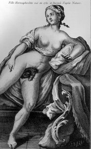 Hermaphroditisches Mädchen, gesehen 1751 und nach der Natur gezeichnet von Unknown artist