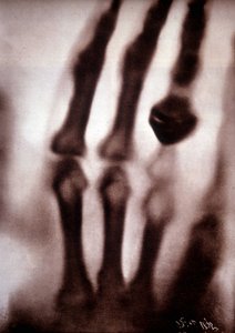 Röntgenstrahlen oder X-Strahlen Erstes Foto: die Hand von Röntgens Frau. 22.12.1895 von Unknown artist