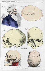 Studie über die Morphologie eines delinquenten Schädels durch den italienischen Kriminologen von Unknown artist