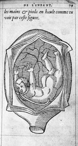 Die Position des Fötus im Uterus während der Schwangerschaft. Gravur aus „De la generation des enfants“ von dem französischen Arzt und Chirurgen Ambroise Paré (1509-1590) 16. Jahrhundert von Unknown artist