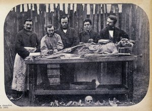 Dissektion, ca. 1865 von Unknown photographer