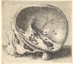 Profil eines geschnittenen Schädels nach links mit entferntem linken Schädelteil, 1651