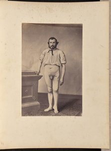 Erfolgreiche Exzision des Kopfes des linken Oberschenkelknochens bei Schussfraktur von William H. Bell