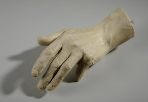 Abguss einer Hand