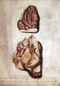 Studie des Gehirns III, um 1850