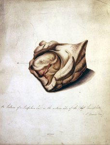 Studie des Gehirns II, ca. 1850