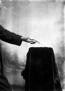 Prothesen - Mann mit einer Prothesenhand von Frederick (attr. to) Barnard