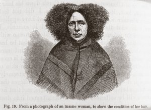 Psychiatrie - Wahnsinnige Frau von Frederick (attr. to) Barnard