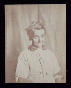 Psychiatrie Porträt eines Patienten, Surrey County Asylum, ca. 1852