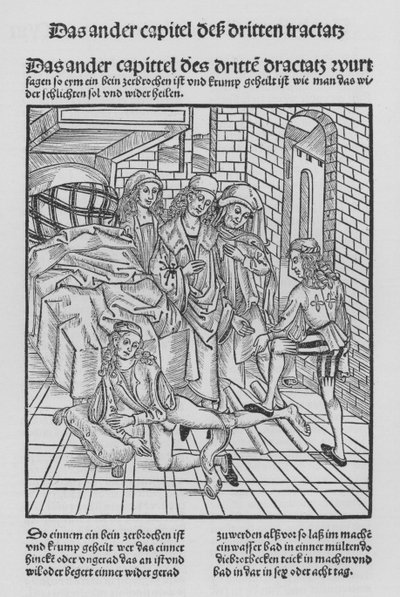 Das Buch der Chirurgie von Hieronymus Brunschwig von (after) German School