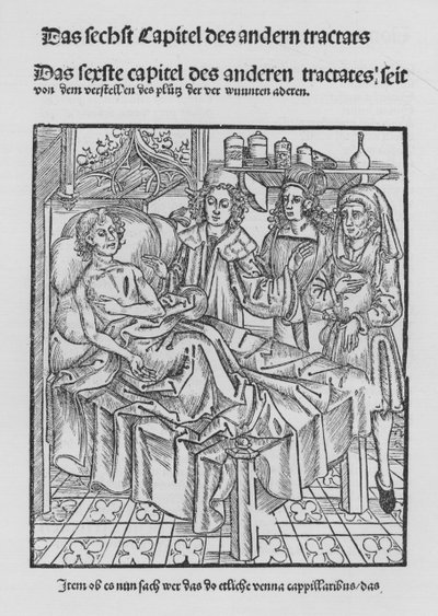 Das Buch der Chirurgie von Hieronymus Brunschwig von (after) German School