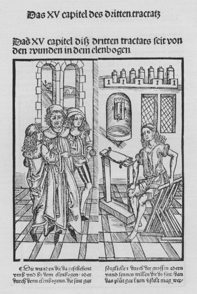 Das Buch der Chirurgie von Hieronymus Brunschwig von (after) German School
