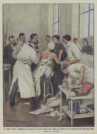 Die heldenhaften Mütter, Bäuerin in Ancona lässt sich die Haut von den Schultern nehmen, um sie ihrem Kind zu geben von Achille Beltrame