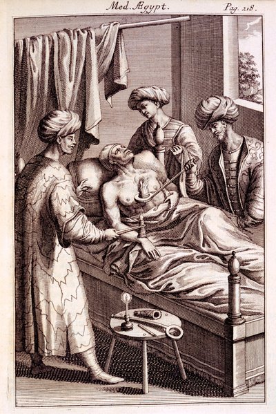 Illustration der Moxibustion aus Medicina Aegyptorum von Prospero Alpinus, 1745 von American School
