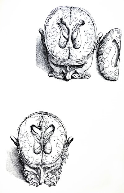 Die Tafeln aus dem siebten Buch der De Humani Corporis Fabrica von Andreas Vesalius