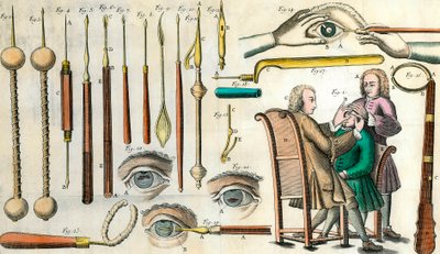 Chirurgie im 18. Jahrhundert: Augenoperation. Instrumente für die Kataraktoperation und künstliche Pupillenbildung. Gravur in „Institutionis chirurgicae“ von Lorenzo Heister von Anonymous Anonymous