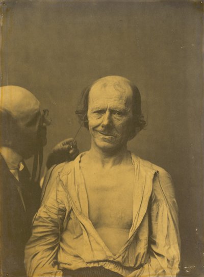 Ein entspanntes Gesicht links, falsche Freude oder Lachen rechts, 1854-1856, gedruckt 1862 von Duchenne de Boulogne