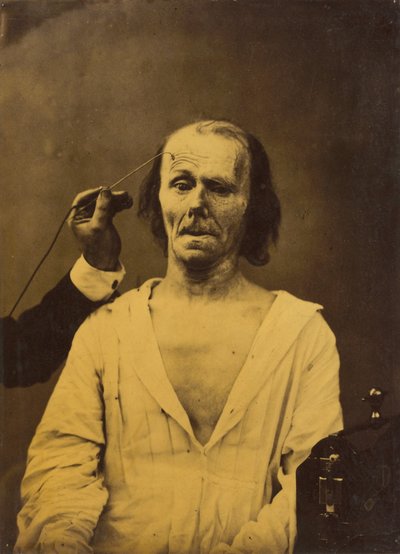 Ein entspanntes Gesicht links, tiefe Aufmerksamkeit rechts, 1854-1856, gedruckt 1862 von Duchenne de Boulogne