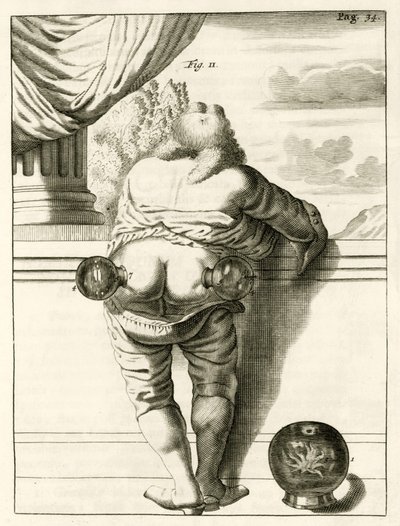 Ein Beispiel für Schröpfen, aus Exercitationes Practicae circa Medendi Methodum von Frederik Dekkers, 1694 von Dutch School