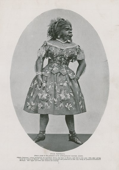 Julia Pastrana von English Photographer
