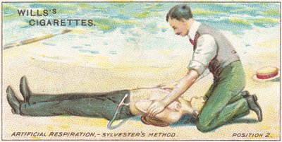 Künstliche Beatmung, Sylvesters Methode - Position 2, Nr. 17 aus der Erste-Hilfe-Serie von Willss Zigarettenkarten, 1913 von English School