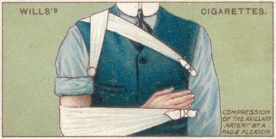 Kompression der Achselarterie durch ein Polster und Beugung, Nr. 41 aus der Erste-Hilfe-Serie von Willss Zigarettenkarten, 1913 von English School
