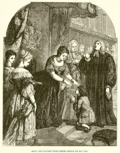 Königin Anne berührt den jungen Samuel Johnson wegen des Übels von English School