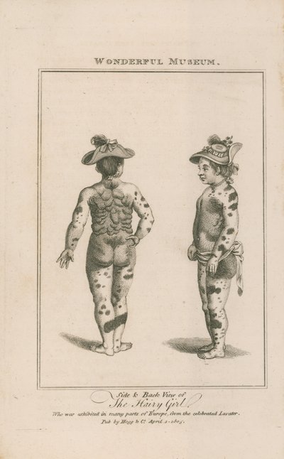 Seiten- und Rückansicht des haarigen Mädchens von English School
