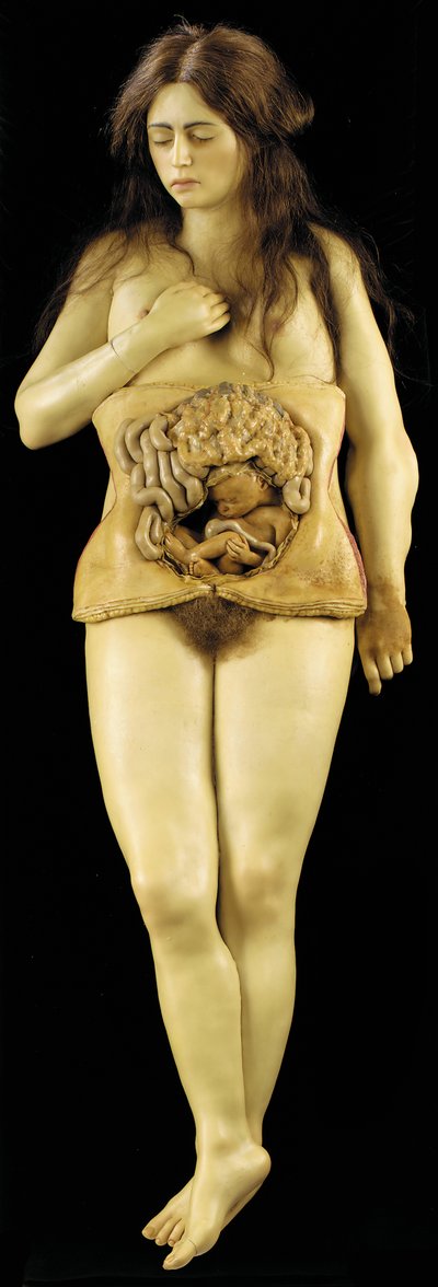 Anatomisches Modell einer Eileiterschwangerschaft von European School