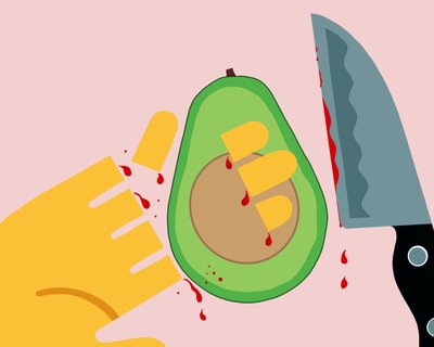 Avocado-Hand von Evan Sklar