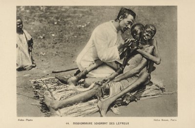 Missionar kümmert sich um Leprakranke von French Photographer