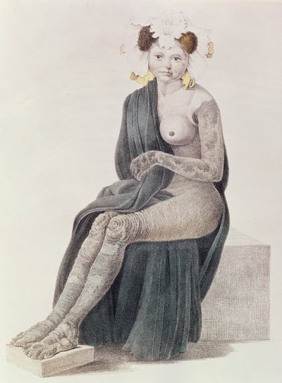 Kongenitale Ichthyose, aus einem Buch von G.M. Olbers, 1830 von French School