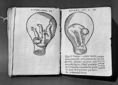 Fötus im Mutterleib, Illustration aus dem sogenannten Rhodion-Manuskript von French School