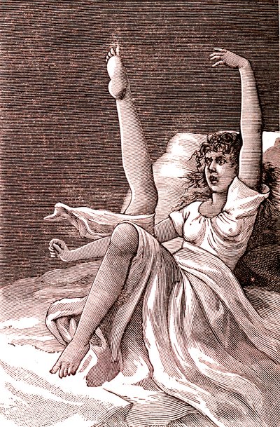 Hysterie, ein extrem mentales Phänomen, Psychosen und Psychoneurosen. 1887 (Gravur) von French School