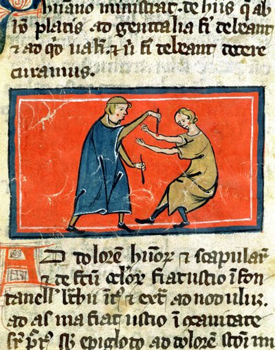 Ms H 89 Arzt kauterisiert eine Wunde mit Feuer, aus einer Ausgabe des Buches der Chirurgie von Rogier de Salerne von French School