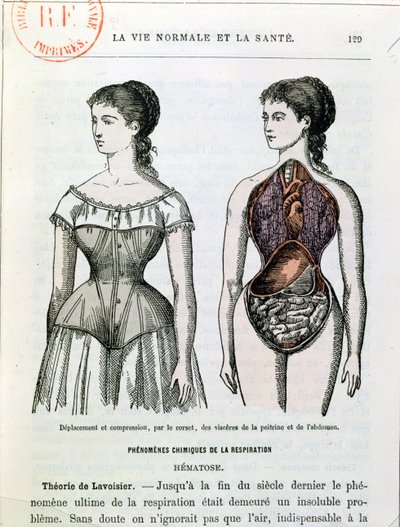 Die schädlichen Auswirkungen des Korsetts, Illustration aus La Vie Normale et la Santé von Dr. Jules Rengade (geb. 1841) ca. 1880 von French School