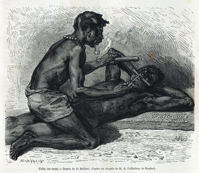 Das Zähnefeilen in Okanda, Zeichnung von D. Maillard, zur Illustration der Geschichte einer Reise nach Gabun und zum Ogoue-Fluss in den Jahren 1875-1877, von Alfred Marche. Gravur in Le tour du monde von French School