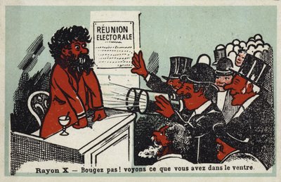 Röntgenstrahlen - Nicht bewegen! Mal sehen, was er im Magen hat von French School