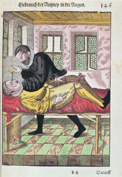 Augenoperation, aus Ophthalmodouleia von Georg Bartisch, veröffentlicht in Dresden 1583 von German School